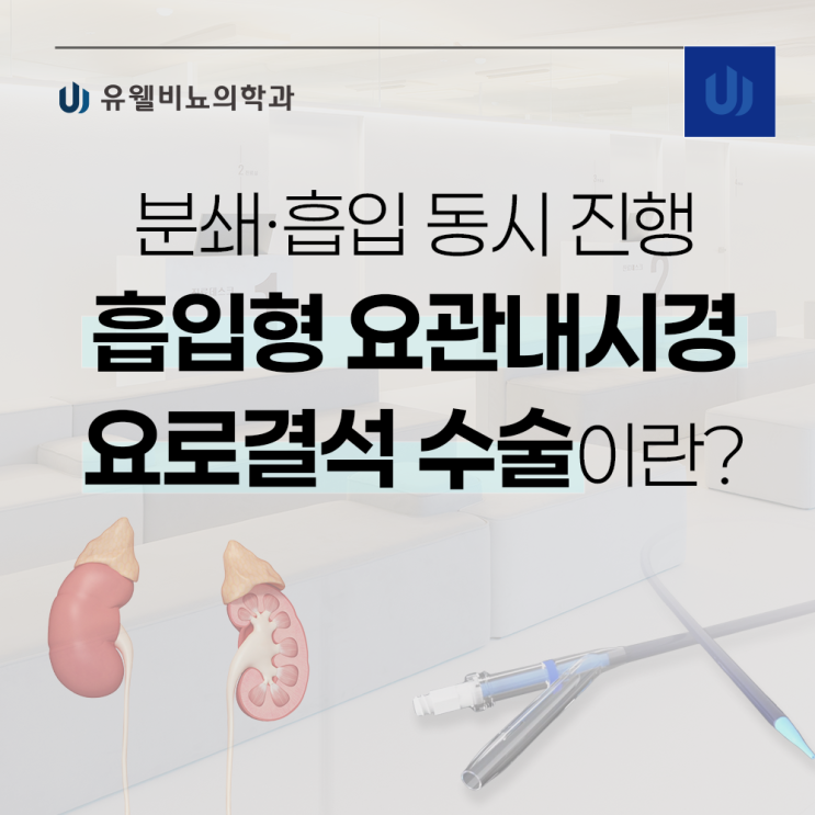 [메디컬투데이] 요로결석 분쇄·흡입 동시 진행 흡입형 요관내시경 수술이란? : 네이버 블로그