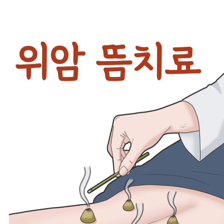 뜸 , 위암증세 뜸치료 암환자 위암4기 쑥뜸 : 네이버 블로그
