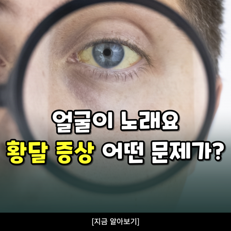 성인 황달증상 황달원인 수치 검사 중요! : 네이버 블로그