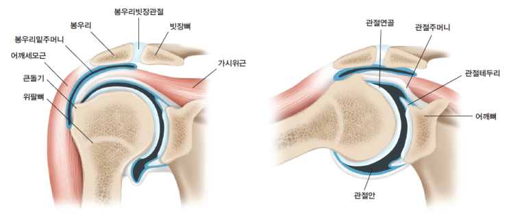 견봉하 삼각근하 점액낭염(SASD bursitis) : 네이버 블로그