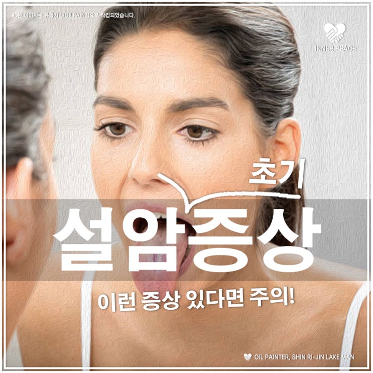 설암 초기증상사진 병원, 전조증상 생존율과 치료방법 early symptoms in the first stage of Oral ...