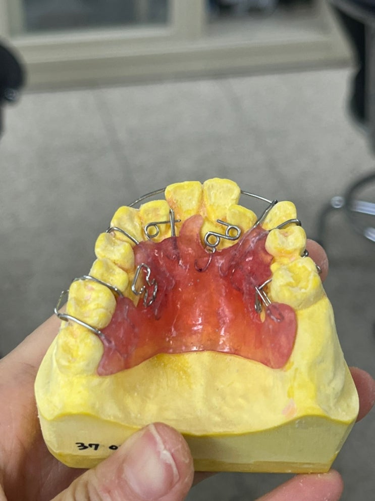 [교정학] 실습 - 가철성 Labial bow, Adams/c clasp, Spring, Base plate : 네이버 블로그