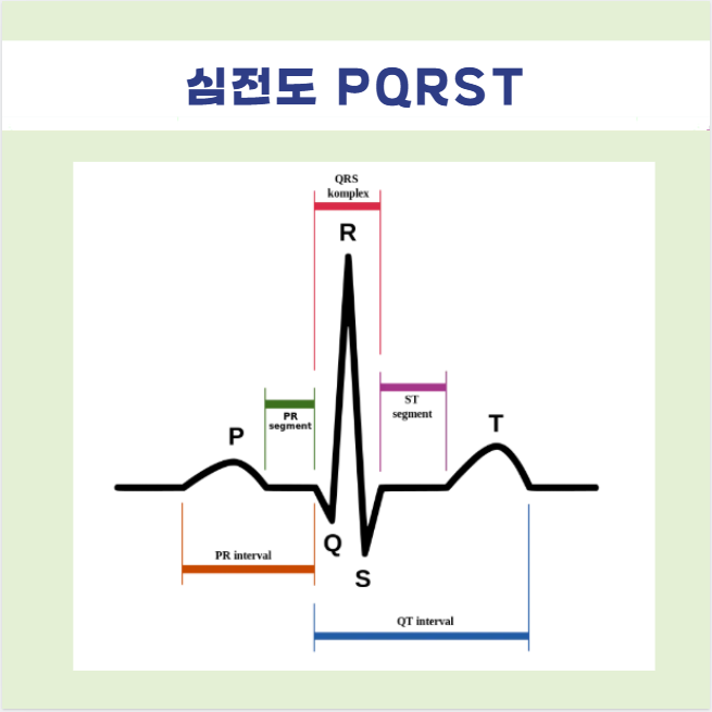 심전도 파형 간격 P파 PR간격 Q파 QRS군 ST 분절 segment T파 PR QT interval 간격 의미 정상범위 ...