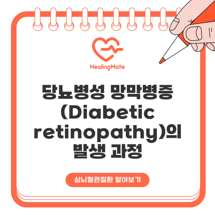 당뇨병성 망막병증(Diabetic retinopathy)의 발생 과정 : 네이버 블로그