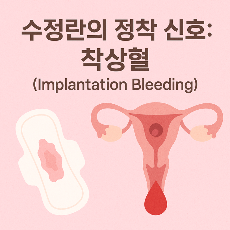 수정란의 정착 신호: 착상혈(Implantation Bleeding)의 이해 : 네이버 블로그