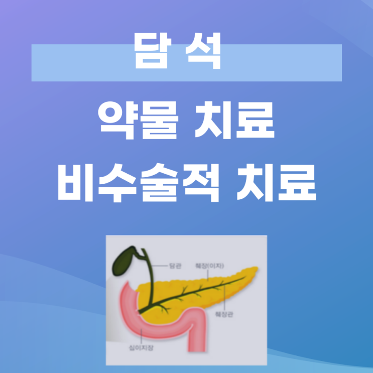 모든 담석이 수술 대상은 아니다 — 약으로 담석 치료하기 (대구 담석 전문 교수) : 네이버 블로그