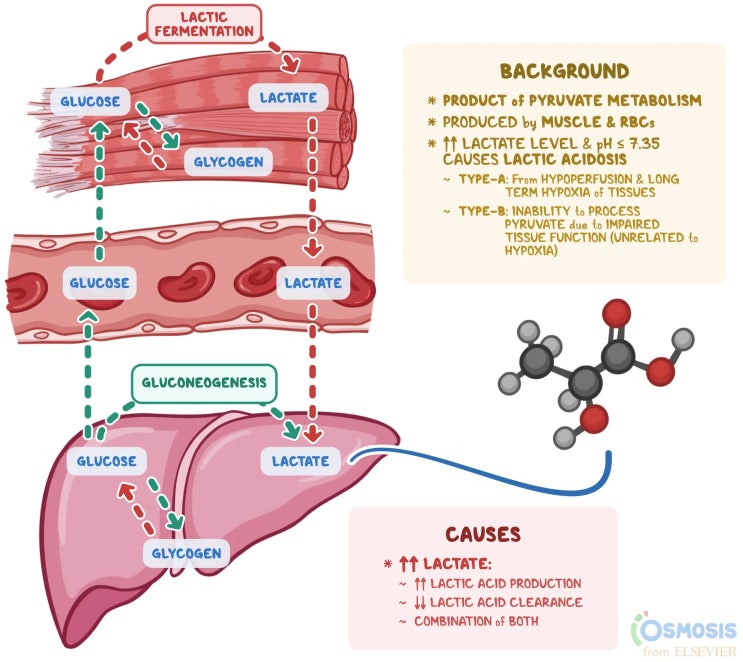 🫁 패혈증·쇼크 환자의 예후 예측! ABGA 젖산산증(Lactic Acidosis) 총정리 : 네이버 블로그