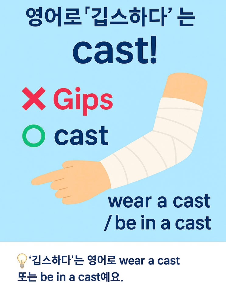 영어로 ‘깁스하다’? — Gips vs cast ⭕ : 네이버 블로그