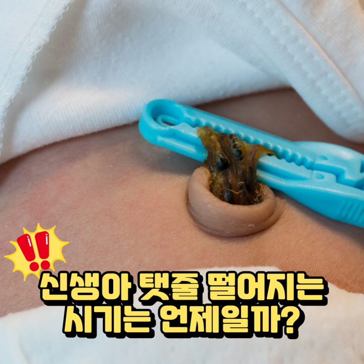 신생아 배꼽 탯줄 떨어지는 시기는 언제? 관리법과 알아봐요 : 네이버 블로그