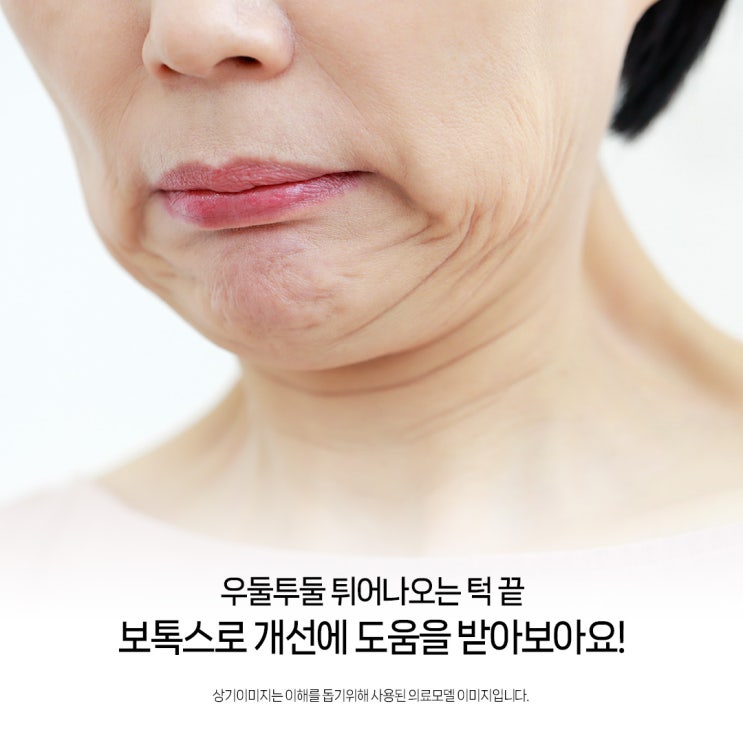 서면 자갈턱보톡스, 턱 끝 근육을 개선하여 매끈하게! : 네이버 블로그