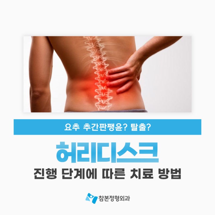 요추 추간판팽윤 증상, 허리디스크 단계별 통증과 치료 방법 : 네이버 블로그