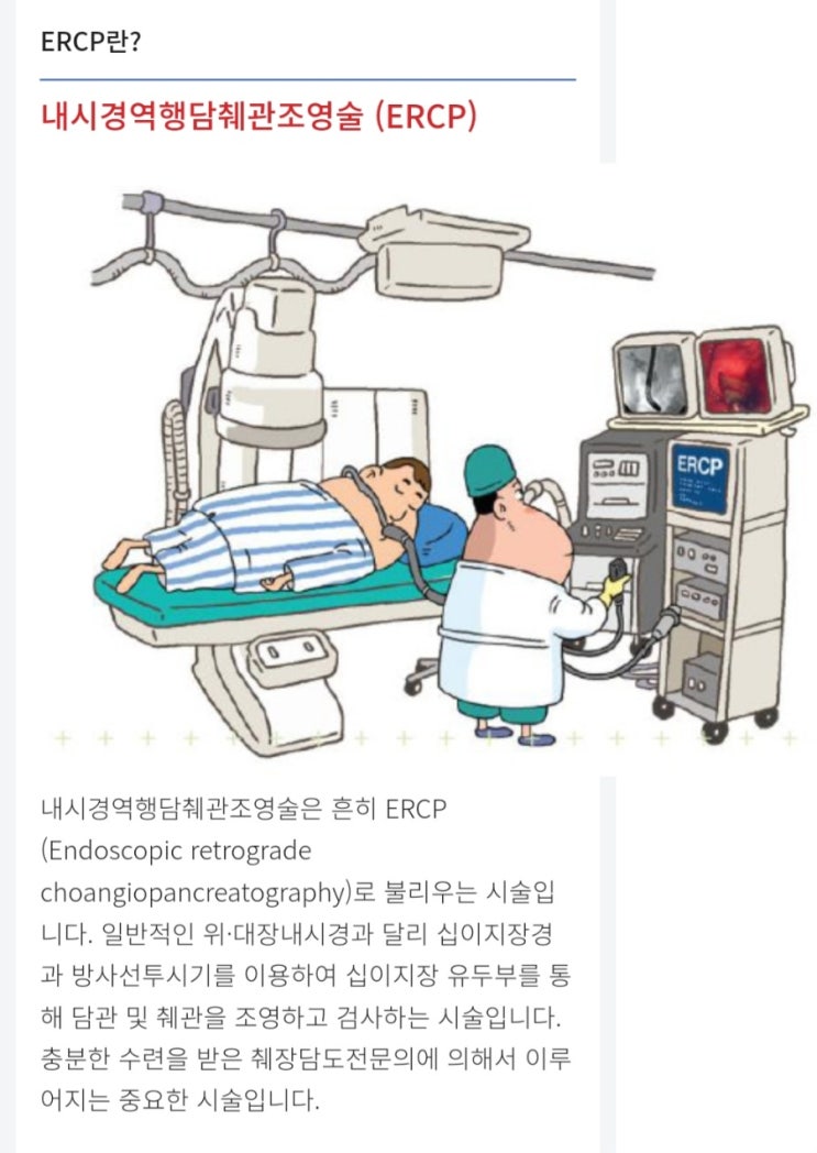 담도 및 췌장 질환의 진단과 치료에 이용되는 표준 시술(ERCP) : 네이버 블로그