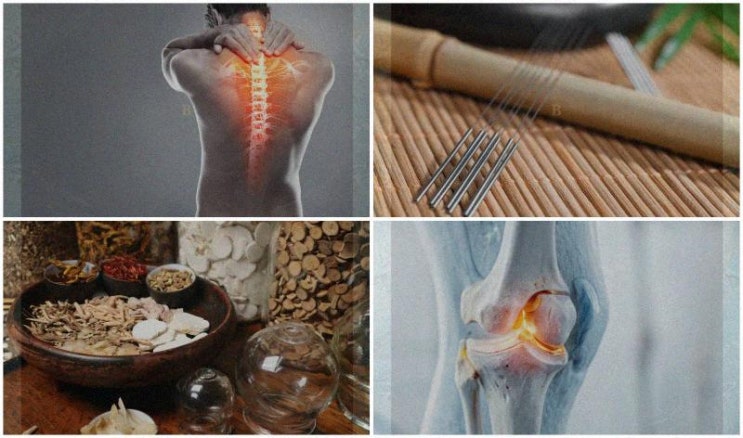 침, 뜸, 체위 한방 치료 전 꼭 알아야 할 세 가지 핵심 정보! : 네이버 블로그