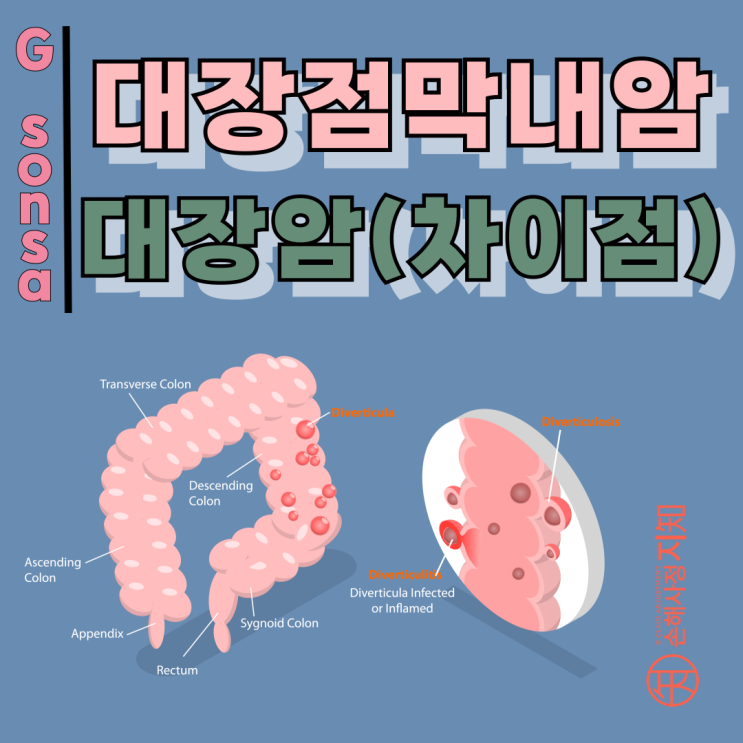 대장점막내암 대장암, 1mm 차이로 생사가 갈린다. - [의학정보, AlDa] : 네이버 블로그