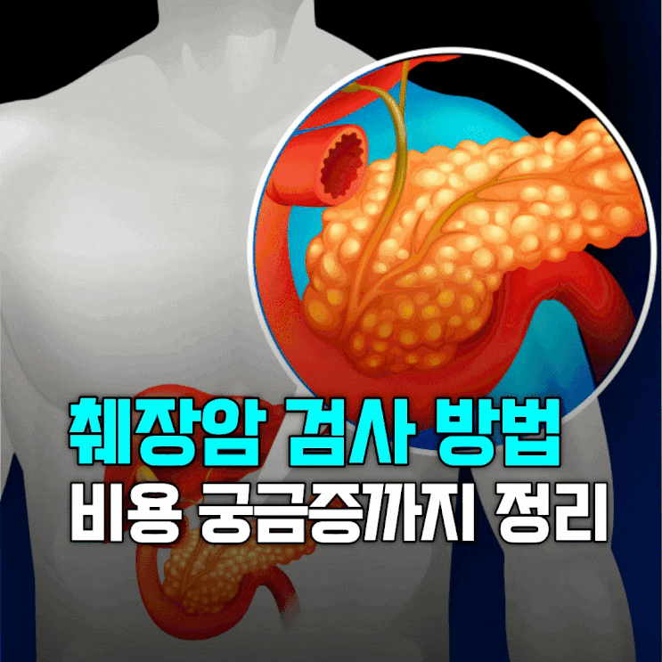 췌장암 검사 방법, 비용 궁금하셨다면 이 글로 정리하세요 : 네이버 블로그