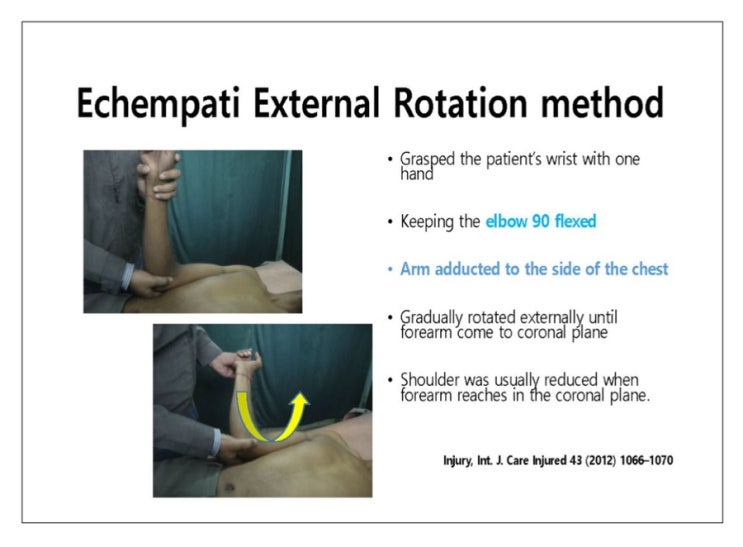 Shoulder dislocation, External rotation : 네이버 블로그