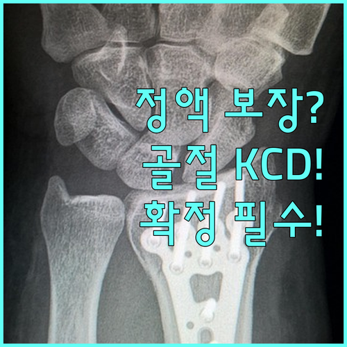 정액 보장 골절진단비 KCD 진단 코드 확정 기준 분석 : 네이버 블로그