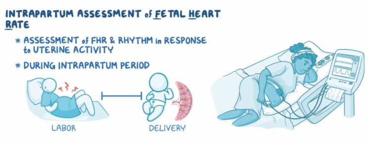 [권주형정형외과] 전자 태아 감시 장치(EFM, electronic fetal monitoring) : 네이버 블로그