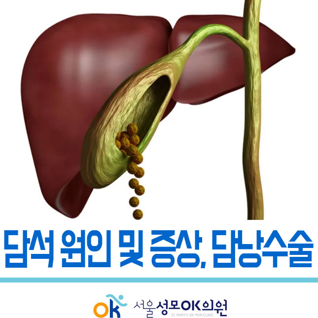 담석 원인 및 증상 '담낭·담석제거 수술 절차와 비용' : 네이버 블로그