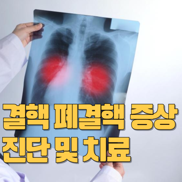결핵 폐결핵 증상 진단 치료 : 네이버 블로그