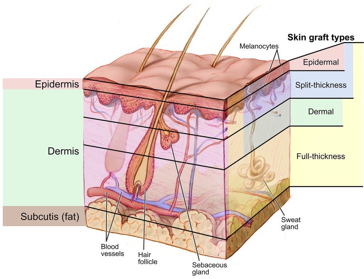 피부이식(skin graft), FTSG vs STSG 비교, 차이점 정리 : 네이버 블로그