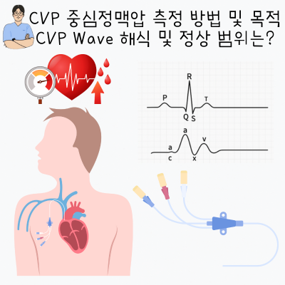 CVP 중심정맥압 의미와 목적 CVP Wave 해석 및 정상범위는? : 네이버 블로그