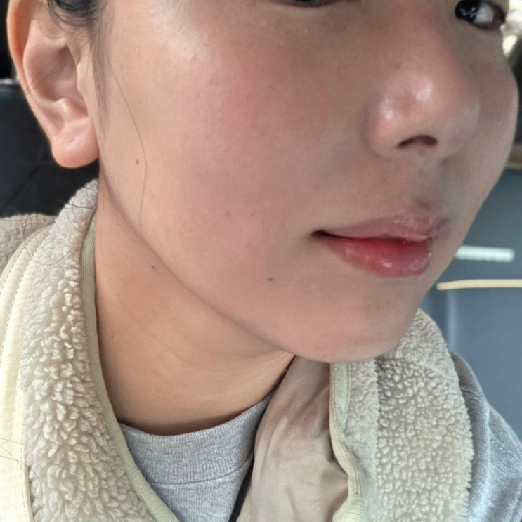 광명에스테틱 엘에스아로마 철산피부관리, 건조한 피부에 딱이었어요!