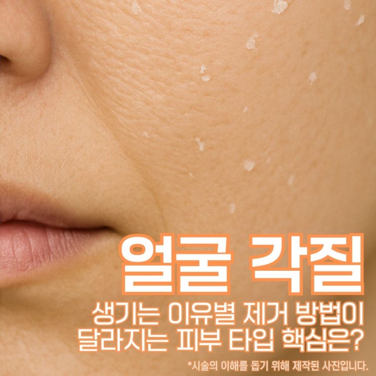 얼굴 각질 생기는 이유별 제거 방법이 달라지는 피부 타입 핵심 : 네이버 블로그