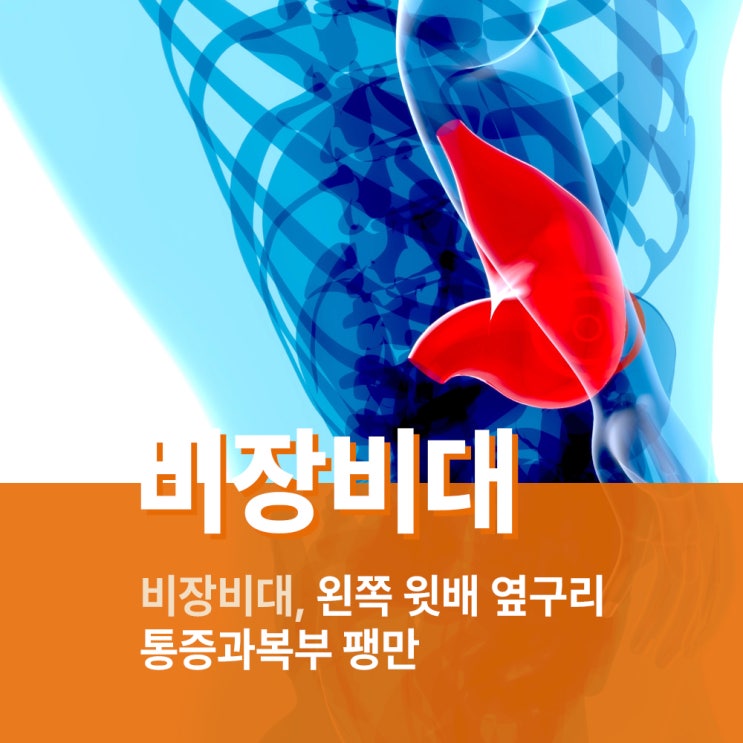 비장비대, 왼쪽 윗배 옆구리 통증과 복부 팽만 : 네이버 블로그