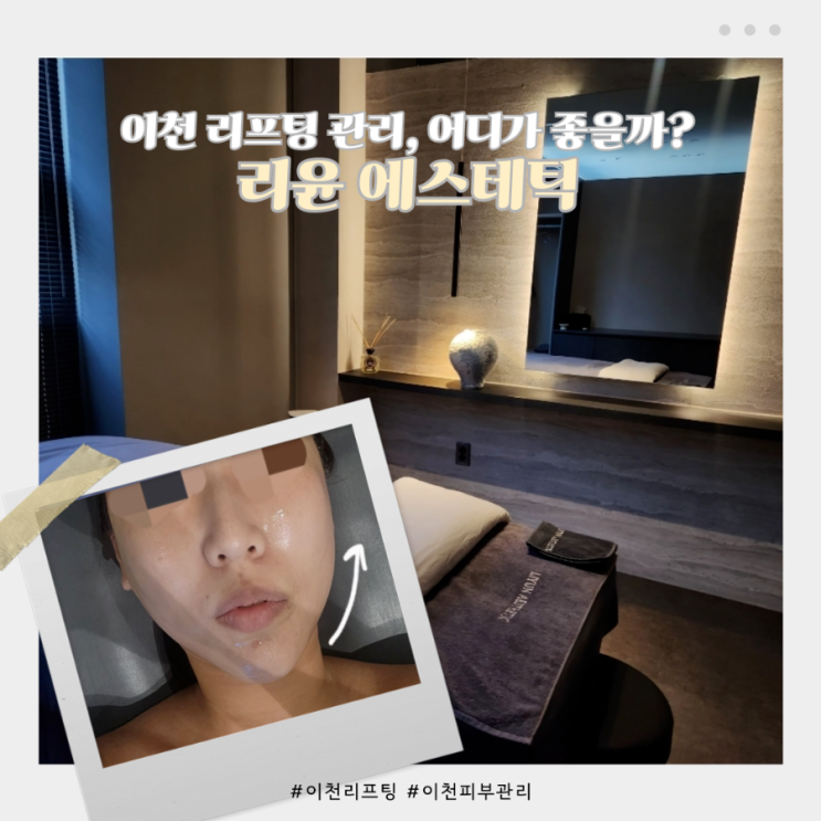 이천 리프팅 관리 추천! 피부 탄력이 달라지는, 관리 한 번으로 얼굴선이 살아나는 리윤 에스테틱 : 네이버 블로그