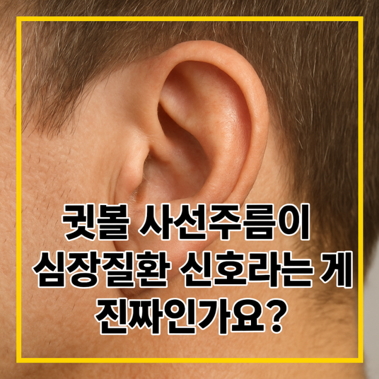 귓볼 사선주름이 심장질환 신호라는 게 진짜인가요? 😮 많은 사람들이 궁금해하는 사실 관계 총정리 : 네이버 블로그