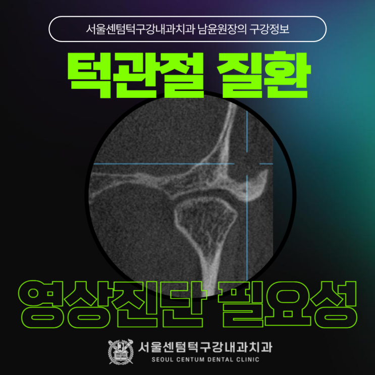 서울 턱관절 : DC/TMD에 기반한 영상(X-ray/CT) 진단 : 네이버 블로그