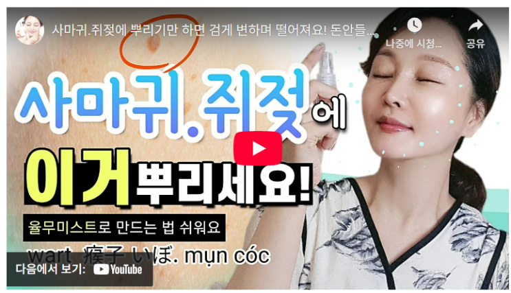 쥐젓, 사마귀 집에서 없애는 방법 율무가루 이용 꿀팁 : 네이버 블로그
