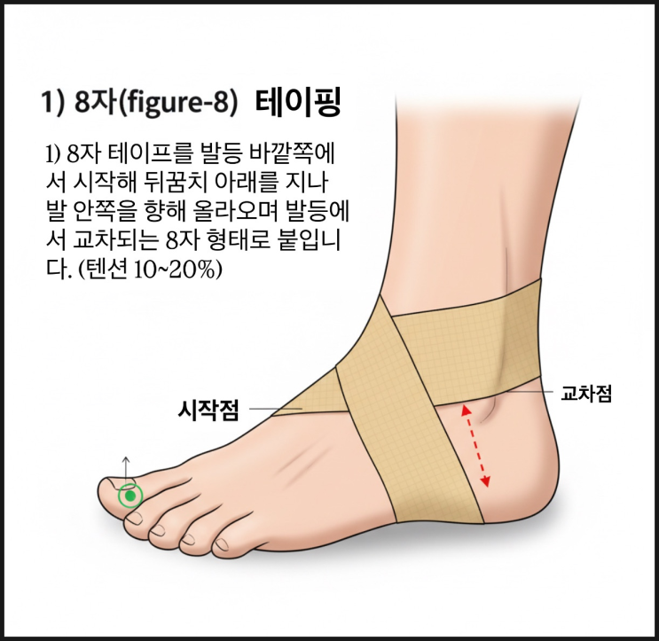 대전야간도수치료, 재활의학과 전문의가 직접 알려주는 발목 염좌 테이핑 방법 3가지 : 네이버 블로그