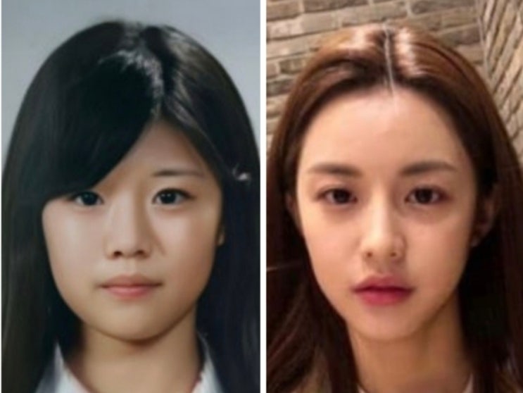💘고윤정 성형전후 분석｜윤곽1편 2종·T절골·긴곡선절제술·무턱교정 턱끝전진술·이마 성형까지 전체 얼굴비율 변화 총정리｜고윤정 ...