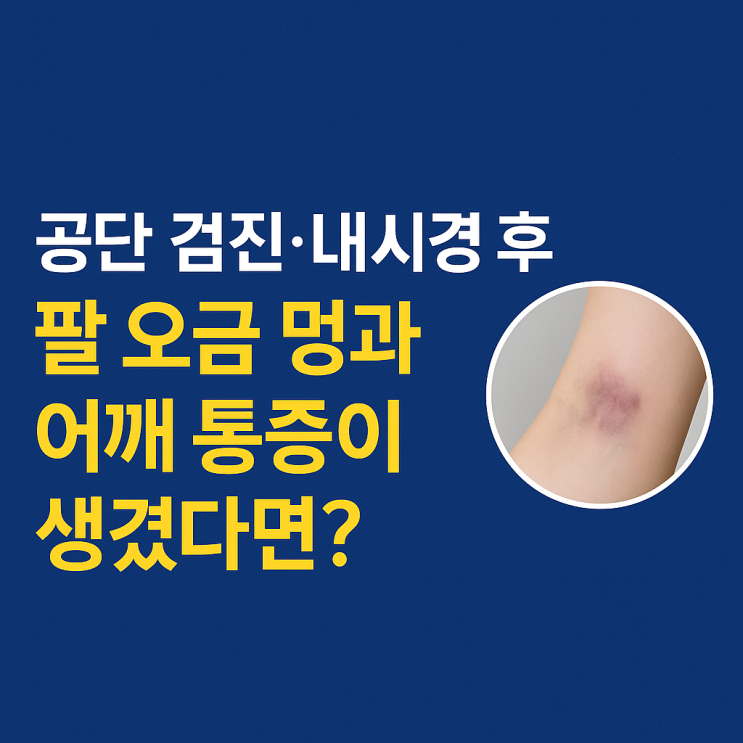 공단 검진·내시경 후 팔 오금 멍과 어깨 통증이 생겼다면? : 네이버 블로그