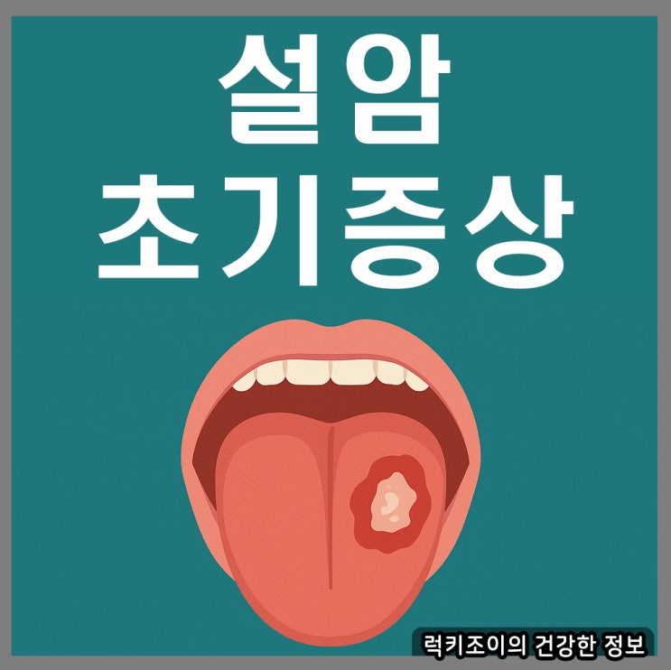 설암 초기증상, 원인과 생존율, 병기별 관리법 정리 : 네이버 블로그
