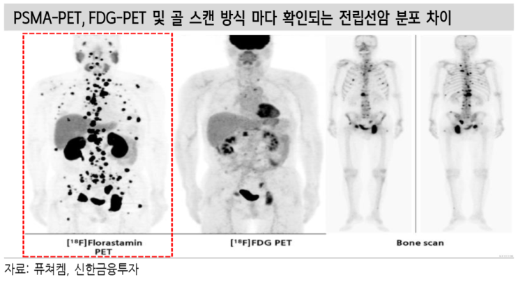 [퓨쳐켐] 2편_플루빅토를 뛰어넘는 FC705, 임상 데이터로 증명된 경쟁력 : 네이버 블로그