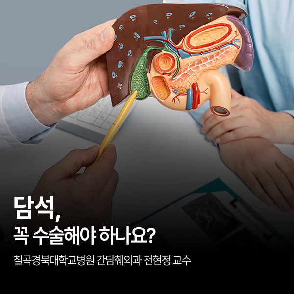 담석, 꼭 수술해야하나요? - 간담췌외과 전현정 교수 : 네이버 블로그
