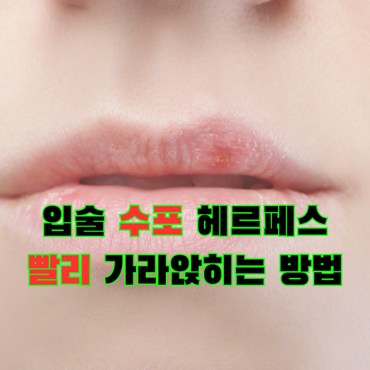 입술 옆 수포 물집 터짐, 전염될까? 헤르페스 증상 관리방법 : 네이버 블로그
