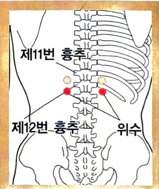 [부항사혈] 위경련, 위하수, 위염, 위궤양으로 인한 식욕부진에 특효혈 자리: 위수혈(胃腧穴) : 네이버 블로그