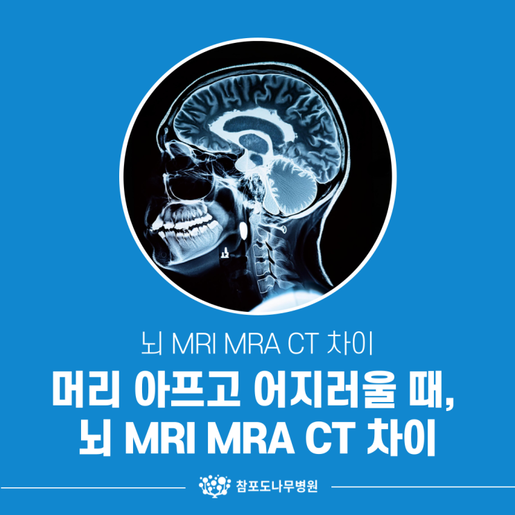 머리 아프고 어지러울 때, 뇌 MRI MRA CT 차이 어떤 검사부터 받아야 하나요? : 네이버 블로그