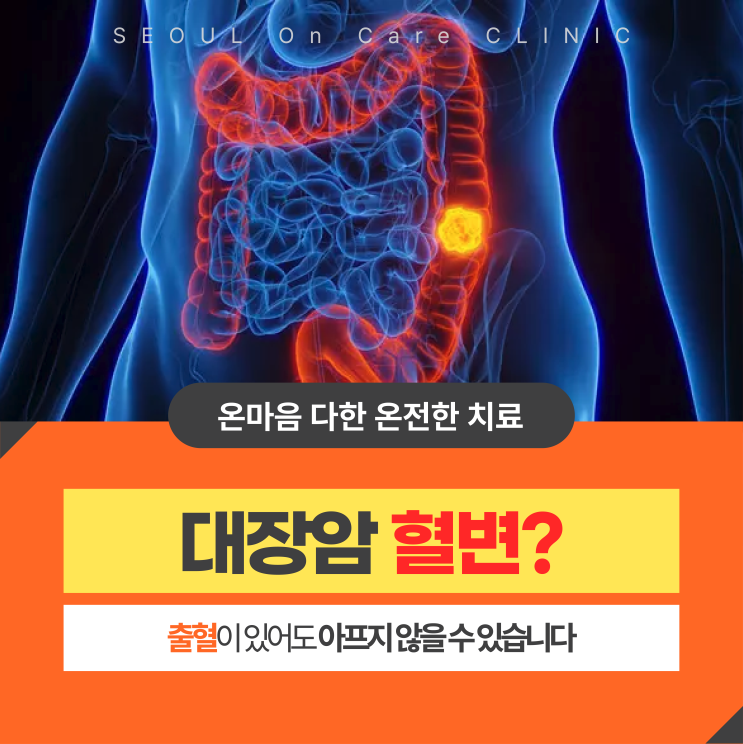 대장암 증상 혈변? 이 징후를 그냥 넘기지 마세요, 대장암일 수 있습니다 : 네이버 블로그
