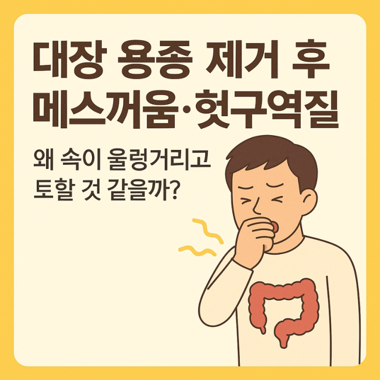 대장 용종 제거 후 메스꺼움·헛구역질🤢 : 네이버 블로그