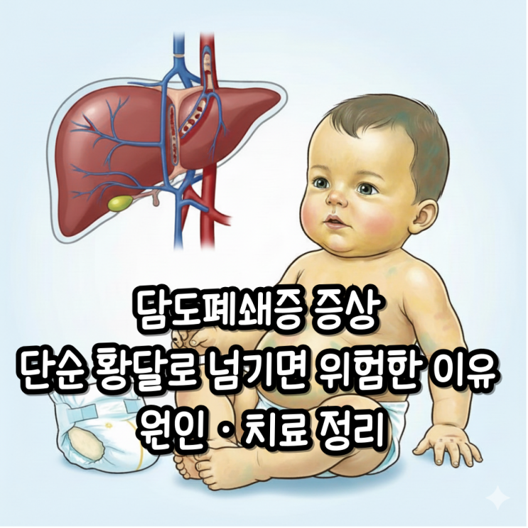 담도폐쇄증 증상 단순 황달로 넘기면 위험한 이유 원인·치료 정리 : 네이버 블로그