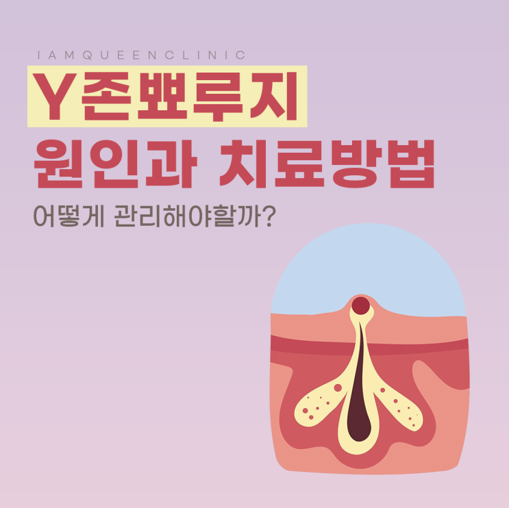y존 뾰루지, 멍울 생기는 원인과 치료방법부터 당일 제거까지 : 네이버 블로그
