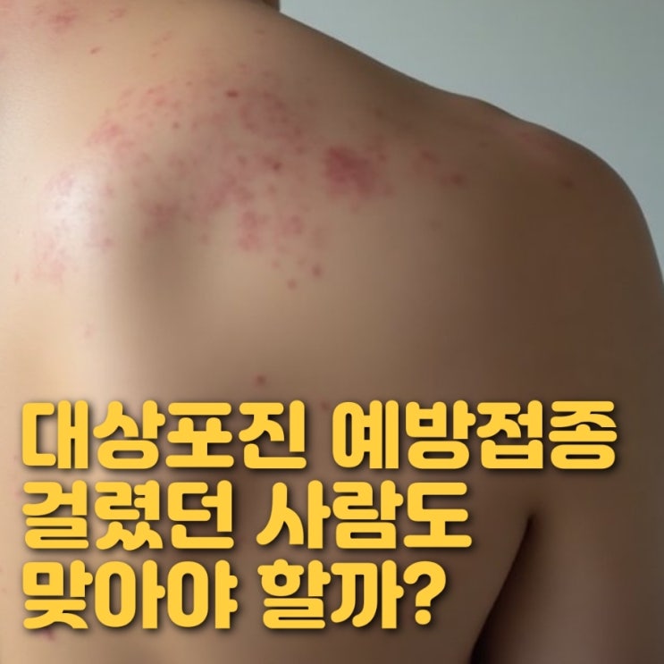 대상포진 예방접종 주기와 효과기간, 걸렸던 사람도 맞아야 할까? : 네이버 블로그