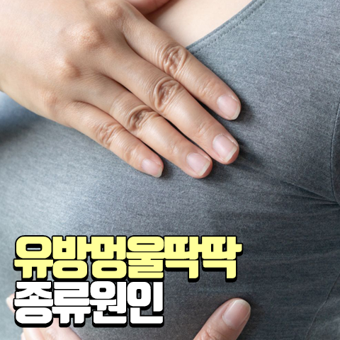 유방에 딱딱한 멍울 유방멍울 종류와 커짐 증상 : 네이버 블로그