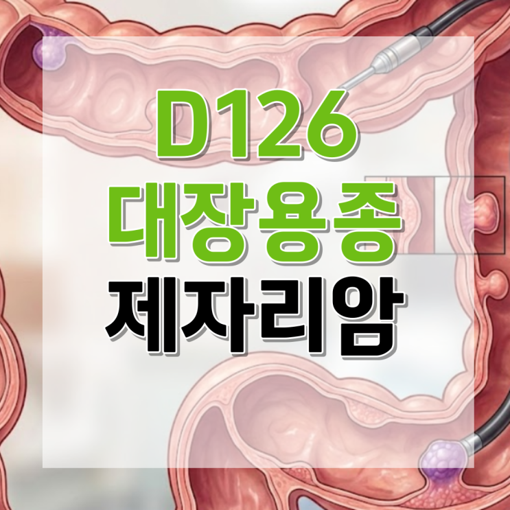 Tubular adenoma D126 대장용종 제자리암진단비 중요한 사항은 무엇일까? : 네이버 블로그