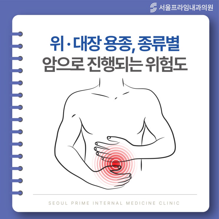 의정부 내과에서 알려주는 위 대장 용종 종류별 암으로 진행되는 위험도 [용종제거 과정 주의사항] : 네이버 블로그
